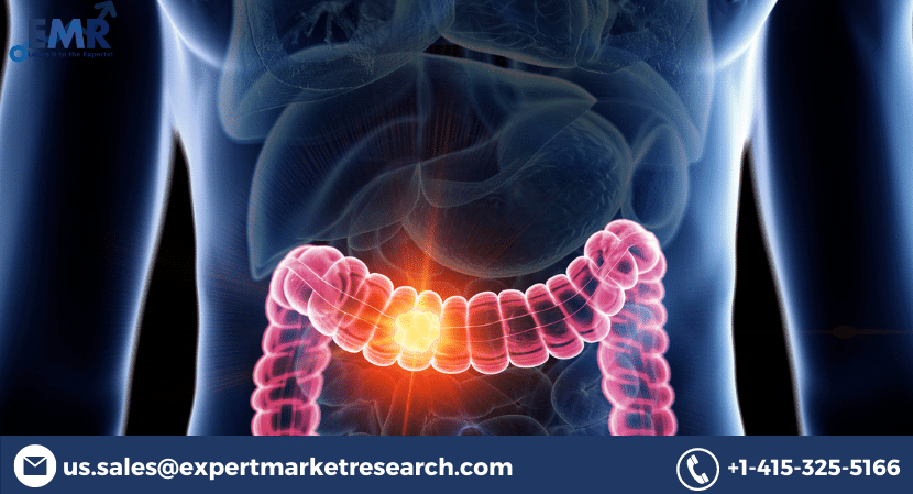 Gastrointestinal Stromal Tumour Market Size, Share, Report, Growth, Industry Analysis ,Price, Trends, Key Players and Forecast Period 2021-2026